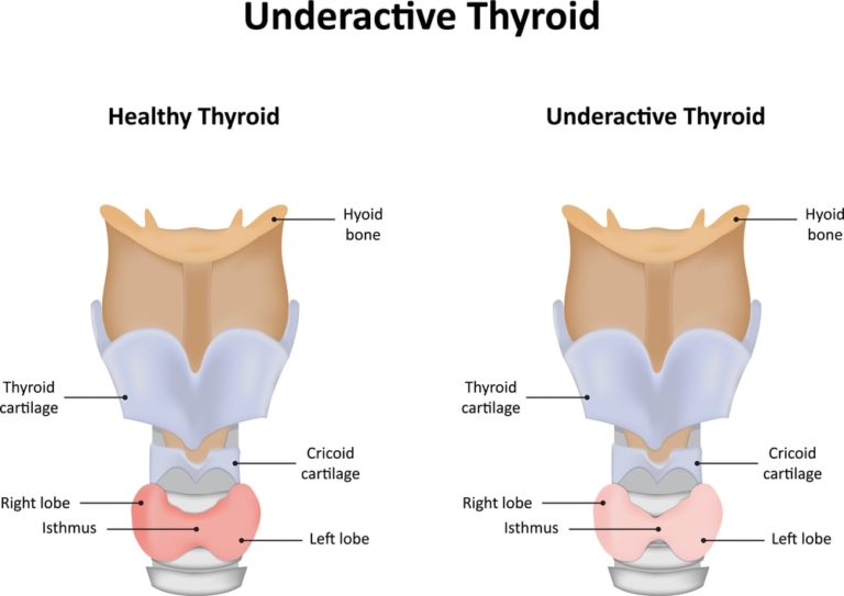 The Vital Importance Of Thyroid Health St Clair Health